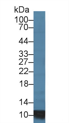 Polyclonal Antibody to S100 Calcium Binding Protein A8 (S100A8)