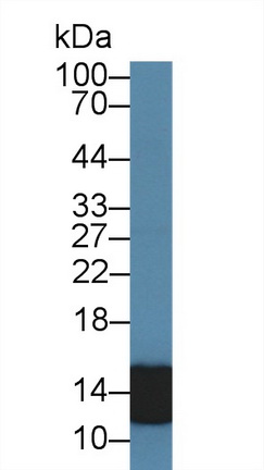 Polyclonal Antibody to S100 Calcium Binding Protein A8 (S100A8)