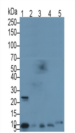 Polyclonal Antibody to S100 Calcium Binding Protein A8 (S100A8)