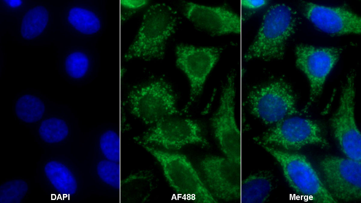 Polyclonal Antibody to S100 Calcium Binding Protein A9 (S100A9)