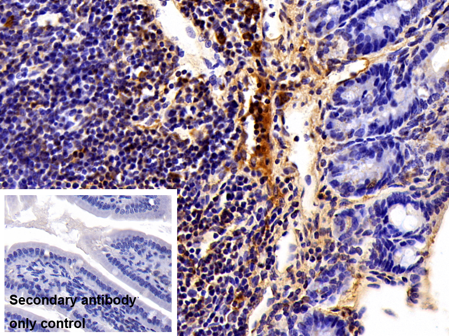 Polyclonal Antibody to S100 Calcium Binding Protein A9 (S100A9)