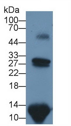 Polyclonal Antibody to S100 Calcium Binding Protein A9 (S100A9)