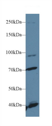 Polyclonal Antibody to Fibroblast Growth Factor Receptor 2 (FGFR2)