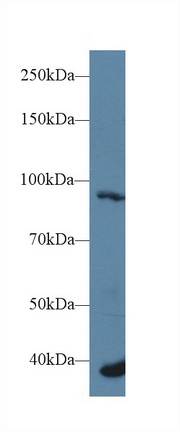 Polyclonal Antibody to Fibroblast Growth Factor Receptor 2 (FGFR2)