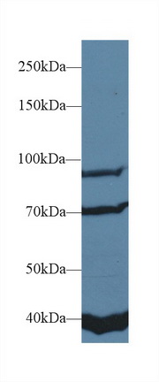 Polyclonal Antibody to Fibroblast Growth Factor Receptor 2 (FGFR2)