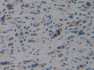 Polyclonal Antibody to Signal Transducer And Activator Of Transcription 2 (STAT2)