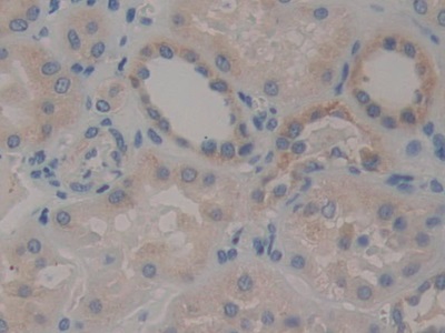 Polyclonal Antibody to Signal Transducer And Activator Of Transcription 2 (STAT2)