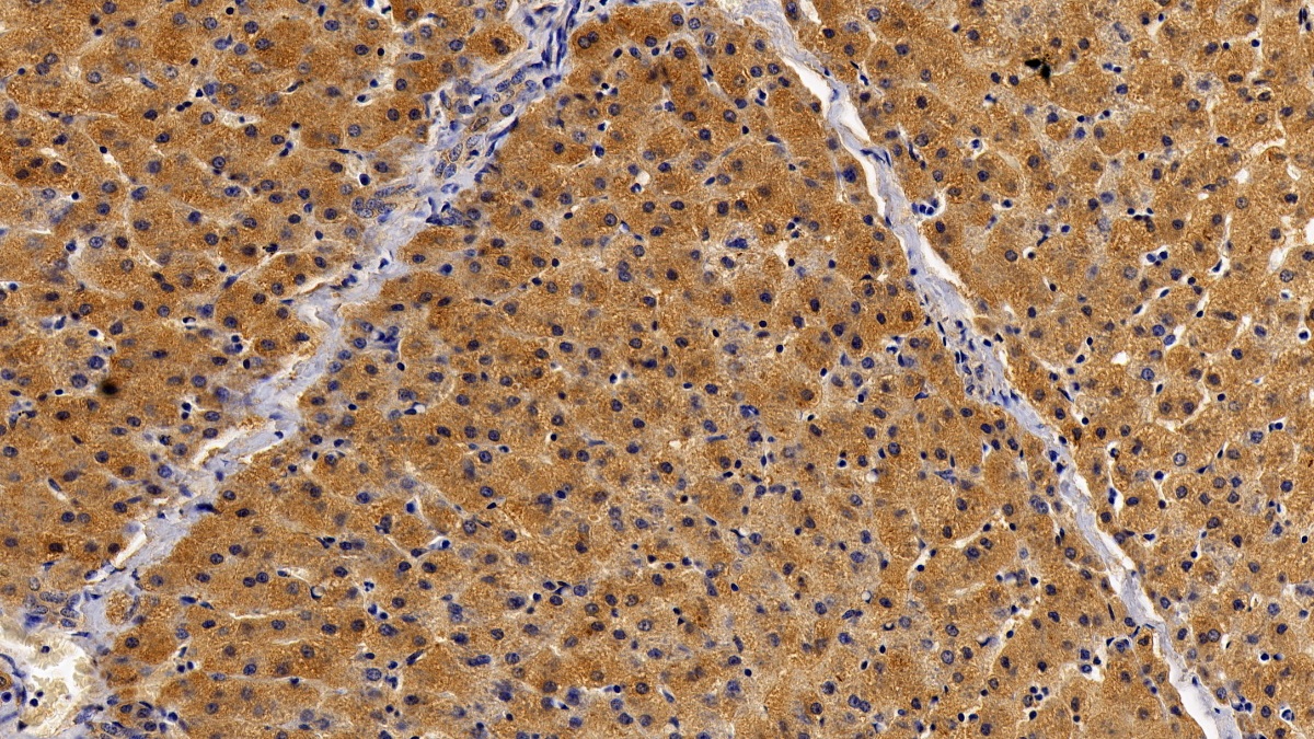 Polyclonal Antibody to Signal Transducer And Activator Of Transcription 2 (STAT2)