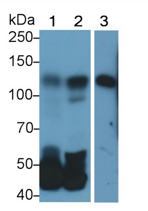 Polyclonal Antibody to Signal Transducer And Activator Of Transcription 2 (STAT2)