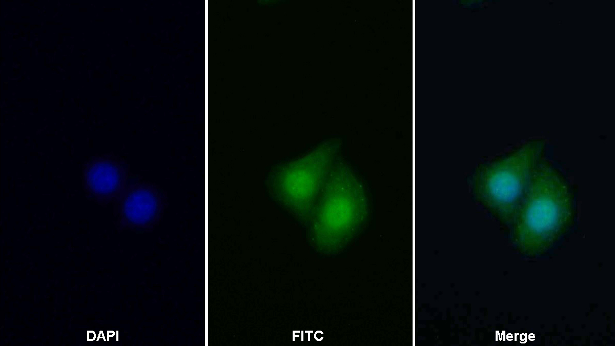 Polyclonal Antibody to Signal Transducer And Activator Of Transcription 2 (STAT2)