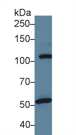 Polyclonal Antibody to Signal Transducer And Activator Of Transcription 2 (STAT2)