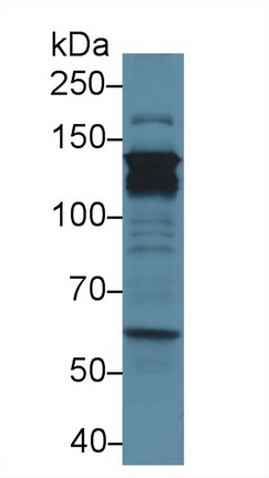 Polyclonal Antibody to Signal Transducer And Activator Of Transcription 2 (STAT2)