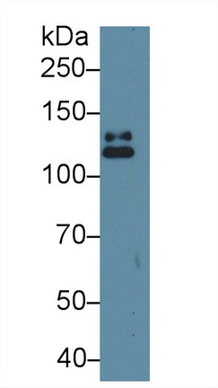 Polyclonal Antibody to Signal Transducer And Activator Of Transcription 2 (STAT2)