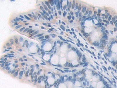 Polyclonal Antibody to Signal Transducer And Activator Of Transcription 2 (STAT2)