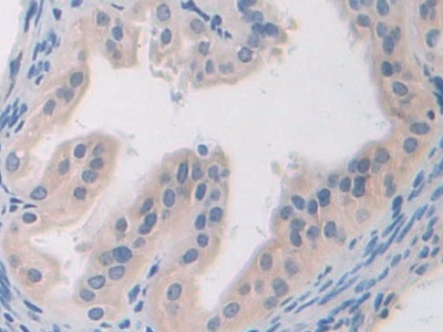 Polyclonal Antibody to Signal Transducer And Activator Of Transcription 2 (STAT2)