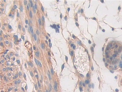 Polyclonal Antibody to Signal Transducer And Activator Of Transcription 2 (STAT2)