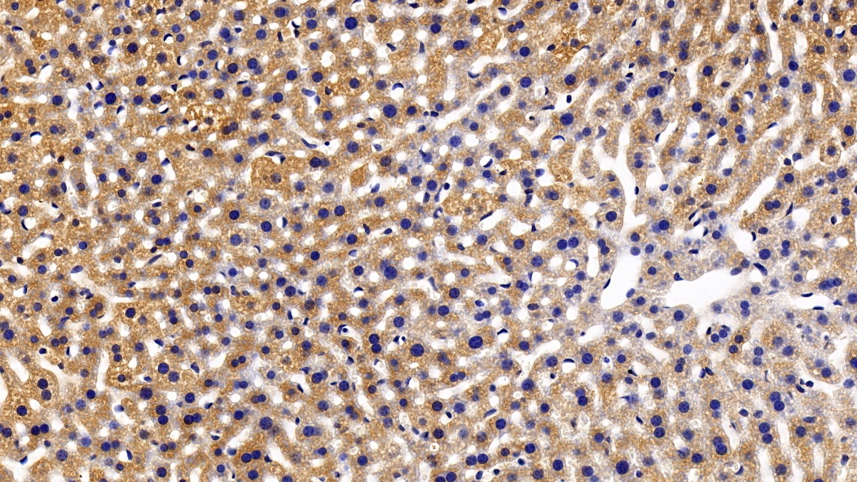 Polyclonal Antibody to Signal Transducer And Activator Of Transcription 2 (STAT2)