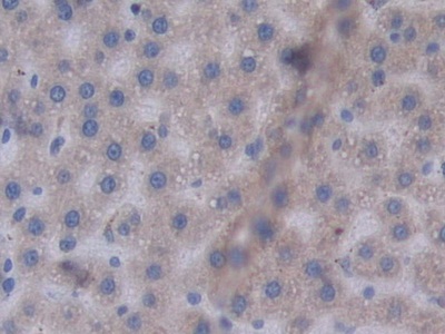 Polyclonal Antibody to Signal Transducer And Activator Of Transcription 2 (STAT2)