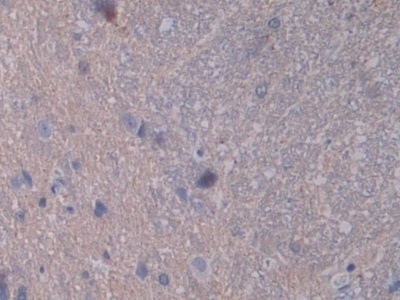 Polyclonal Antibody to Signal Transducer And Activator Of Transcription 2 (STAT2)