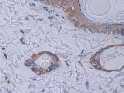 Polyclonal Antibody to Signal Transducer And Activator Of Transcription 2 (STAT2)