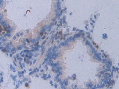 Polyclonal Antibody to Signal Transducer And Activator Of Transcription 2 (STAT2)