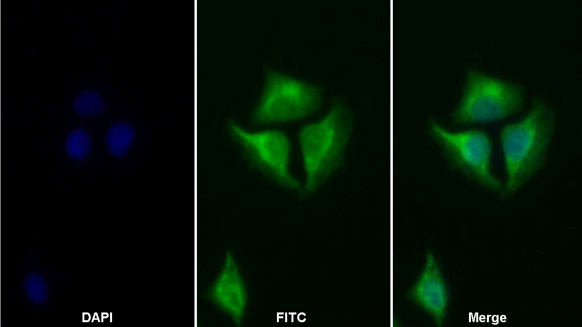 Polyclonal Antibody to Signal Transducer And Activator Of Transcription 2 (STAT2)