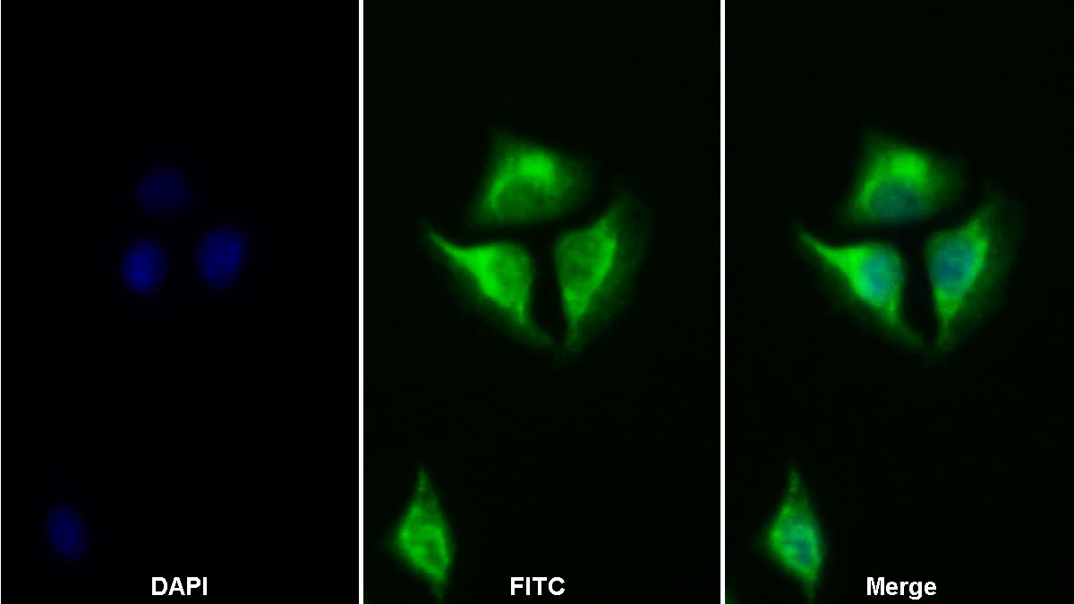 Polyclonal Antibody to Signal Transducer And Activator Of Transcription 2 (STAT2)