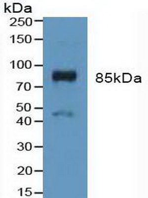 Polyclonal Antibody to Fibroblast Growth Factor Receptor 3 (FGFR3)