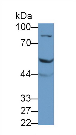 Polyclonal Antibody to Fibroblast Growth Factor Receptor 4 (FGFR4)