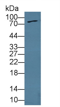 Polyclonal Antibody to Fibroblast Growth Factor Receptor 4 (FGFR4)