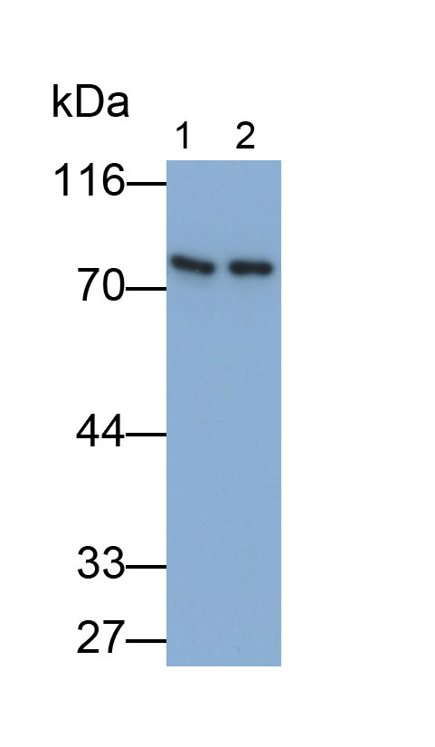 Polyclonal Antibody to Fibroblast Growth Factor Receptor 4 (FGFR4)