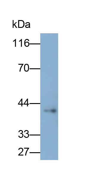 Polyclonal Antibody to Natural Cytotoxicity Triggering Receptor 1 (NCR1)