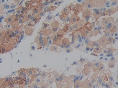 Polyclonal Antibody to Prekallikrein (PK)