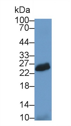 Polyclonal Antibody to Natural Cytotoxicity Triggering Receptor 2 (NCR2)