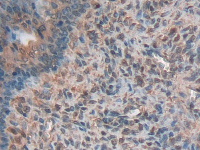 Polyclonal Antibody to High Molecular Weight Kininogen (HMWK)