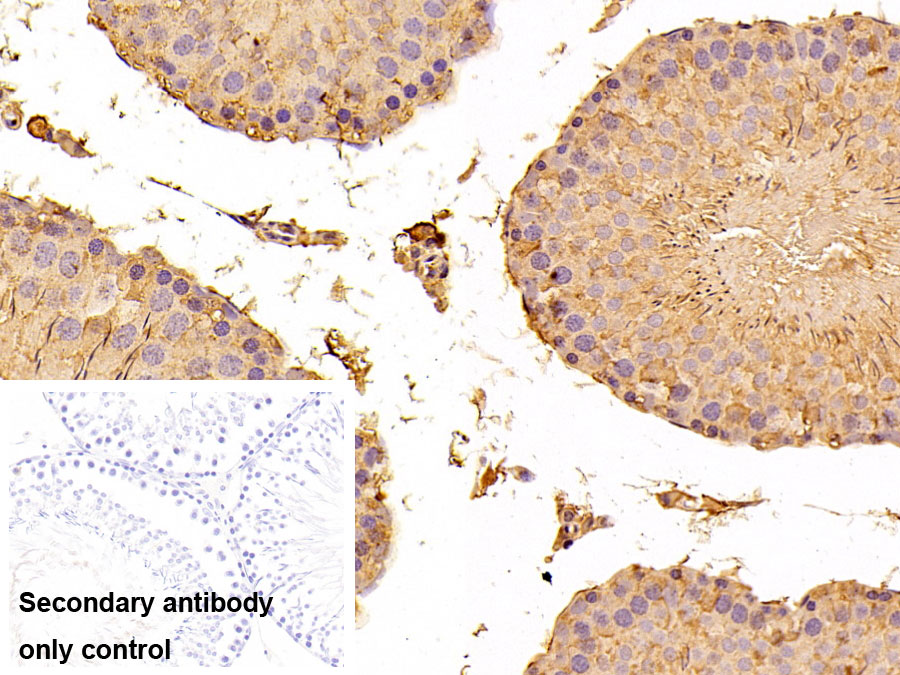 Polyclonal Antibody to Serine/threonine-protein kinase mTOR (mTOR)