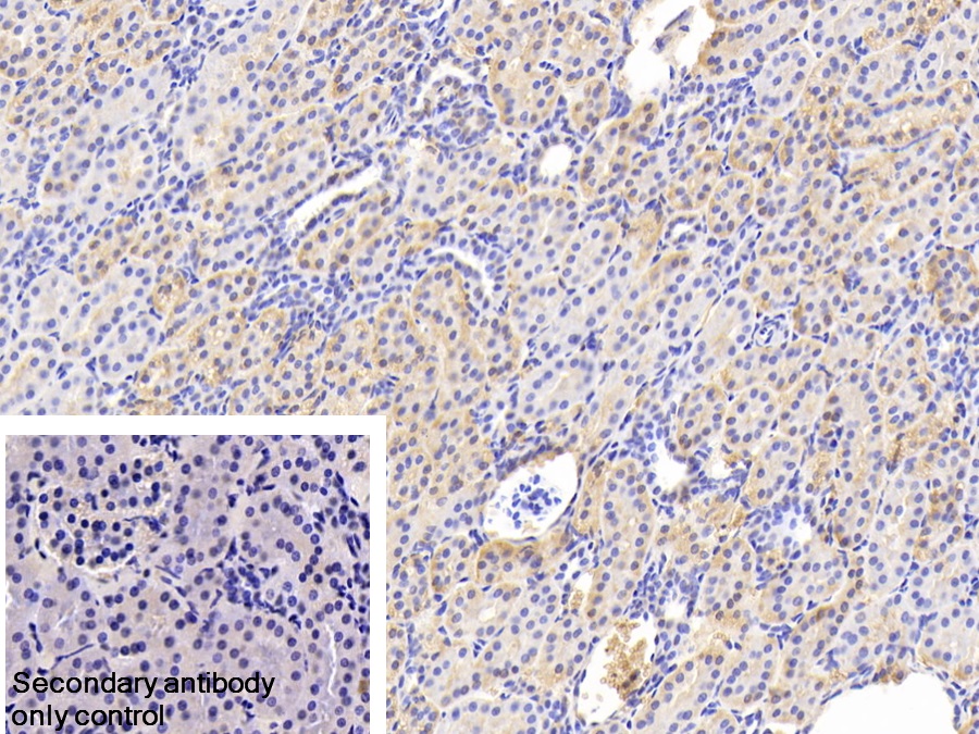 Polyclonal Antibody to Vitamin D Binding Protein (DBP)