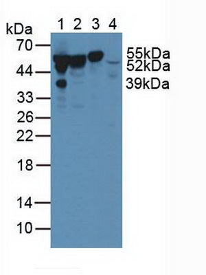 Polyclonal Antibody to Vitamin D Binding Protein (DBP)