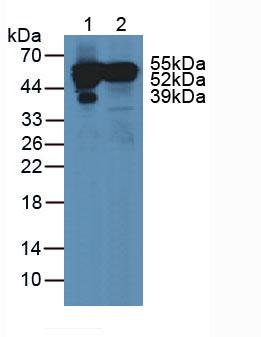 Polyclonal Antibody to Vitamin D Binding Protein (DBP)