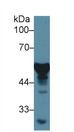 Polyclonal Antibody to Vitamin D Binding Protein (DBP)