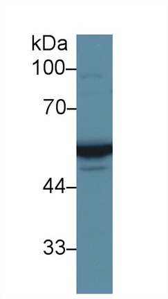 Polyclonal Antibody to Vitamin D Binding Protein (DBP)