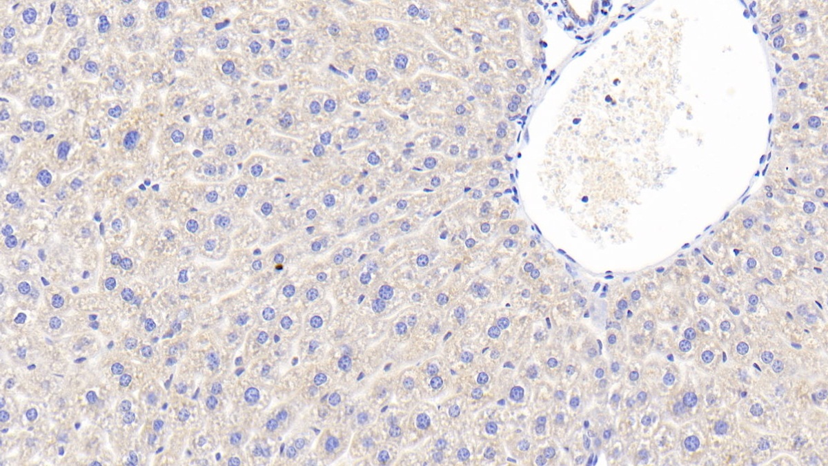 Polyclonal Antibody to Vitamin D Binding Protein (DBP)