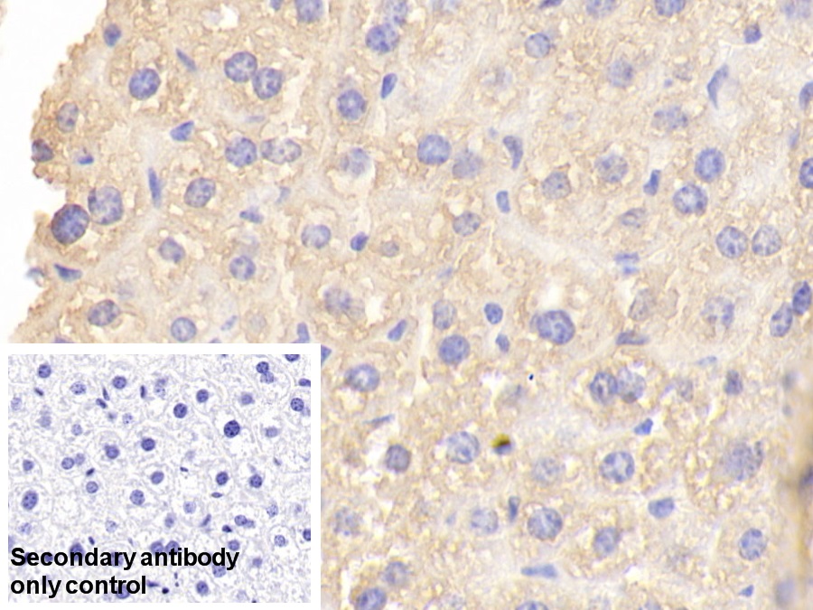 Polyclonal Antibody to Vitamin D Binding Protein (DBP)