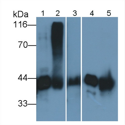 Polyclonal Antibody to Vitamin D Binding Protein (DBP)