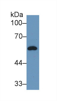 Polyclonal Antibody to Vitamin D Binding Protein (DBP)