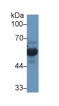 Polyclonal Antibody to Vitamin D Binding Protein (DBP)