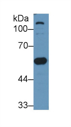 Polyclonal Antibody to Vitamin D Binding Protein (DBP)