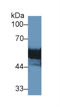 Polyclonal Antibody to Vitamin D Binding Protein (DBP)