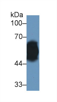 Polyclonal Antibody to Vitamin D Binding Protein (DBP)