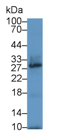 Polyclonal Antibody to Uridine Phosphorylase 1 (UPP1)